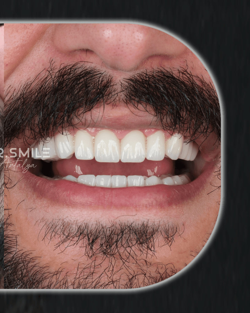 21-Mayis-BA-_0000_Katman-5