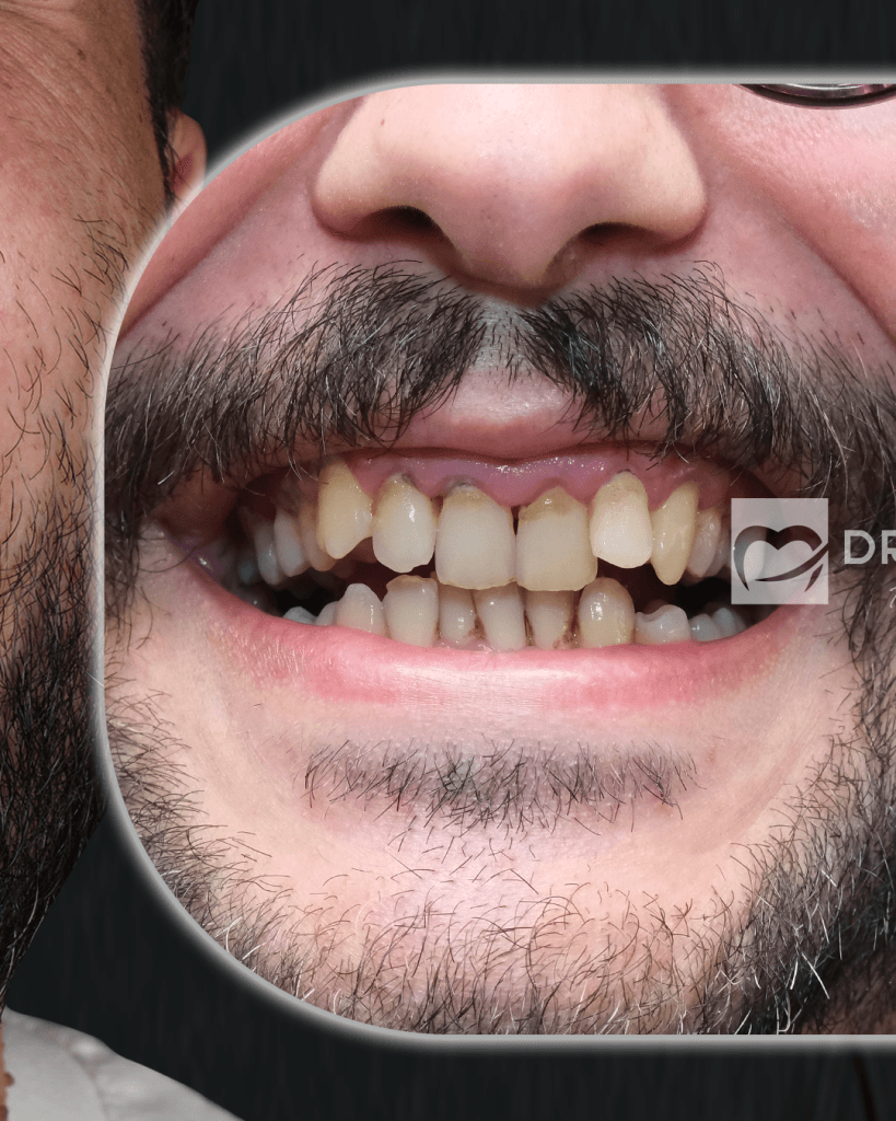 21-Mayis-BA-_0001_Katman-4