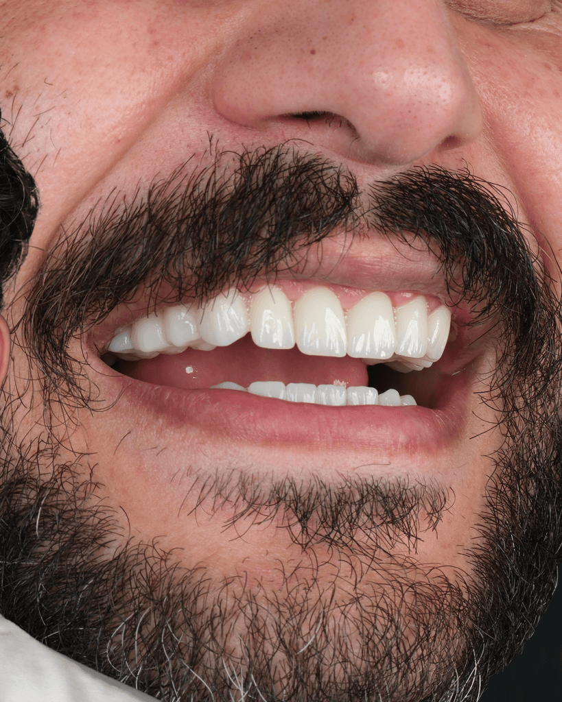 21-Mayis-BA-_0002_Katman-7