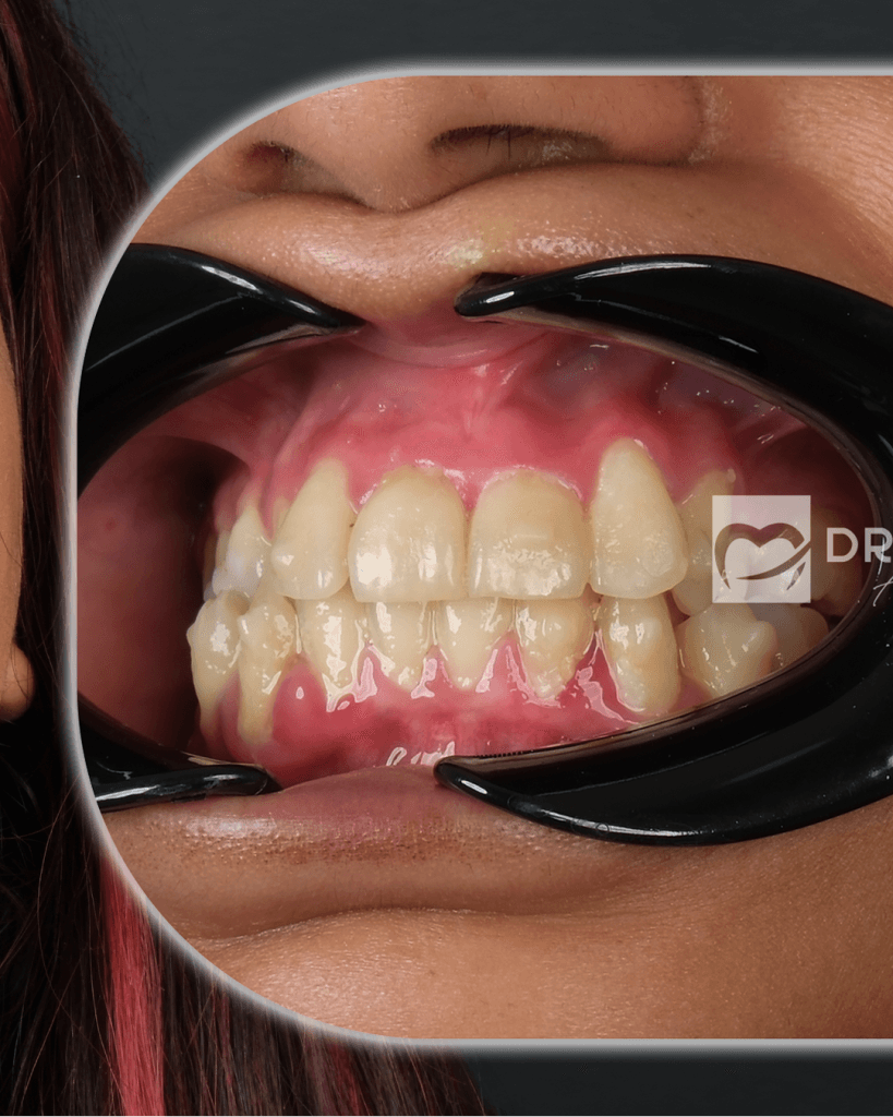 27-Mayis-BA-1_0001_Katman-4