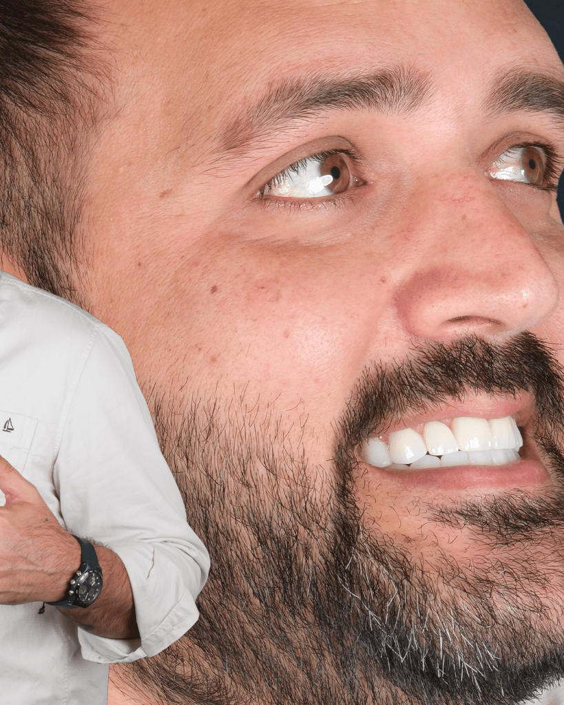 30-Nisan-Before-AfterCalisma-yuzeyi-3