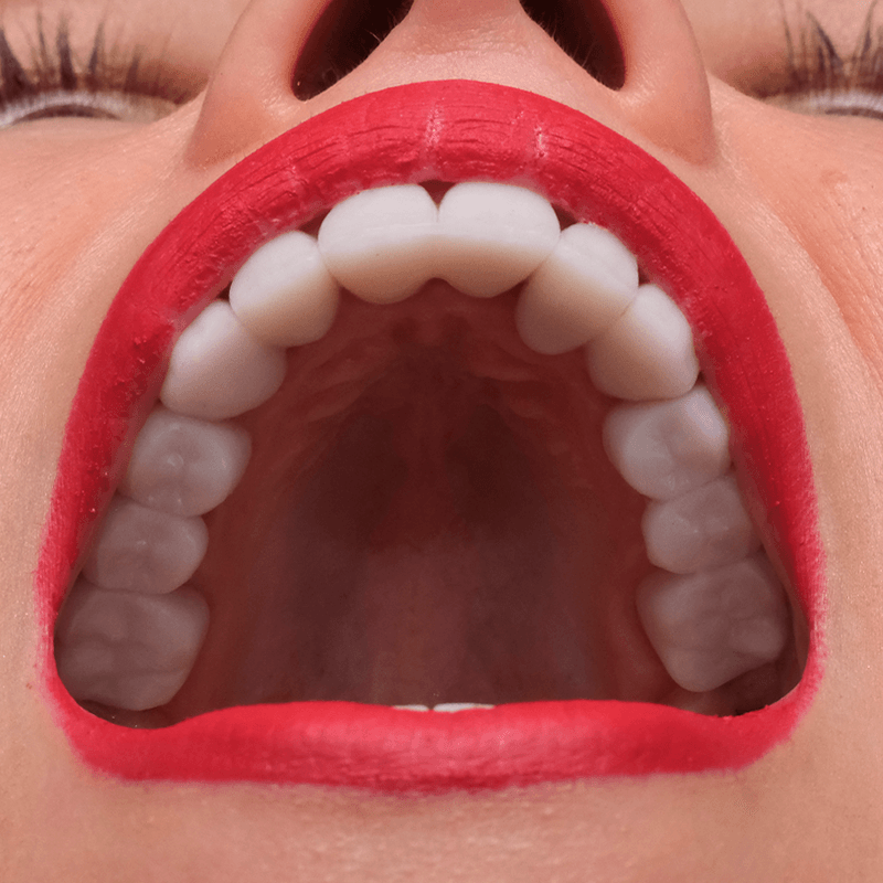 mouth-5